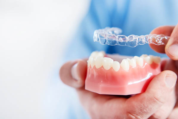 Clear Braces: What Are They? - Karrie Chu DDS Dental Care Pasadena  California