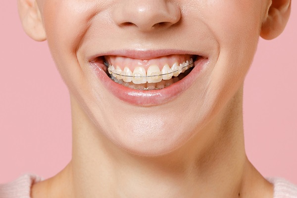 Orthodontics Can Help Self Esteem And Confidence